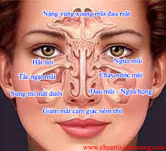 Thuốc nam trị viêm xoang cấp và mạn tính, viêm mũi dị ứng